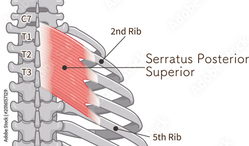 Foto 上後鋸筋のイラスト、serratus posterior superior