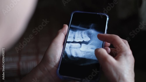 An unrecognizable woman looks at a close-up of a CT scan of her teeth. A wisdom tooth is visible in the frame.