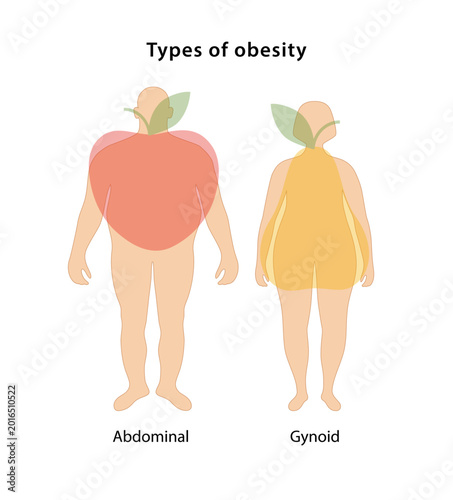 Types of obesity: abdominal and gynoid. Vector illustration of abdominal and gynoid types of obesity in flat style isolated over white background.