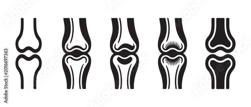 Foto Human joint icons set. showing bone anatomy on white background.