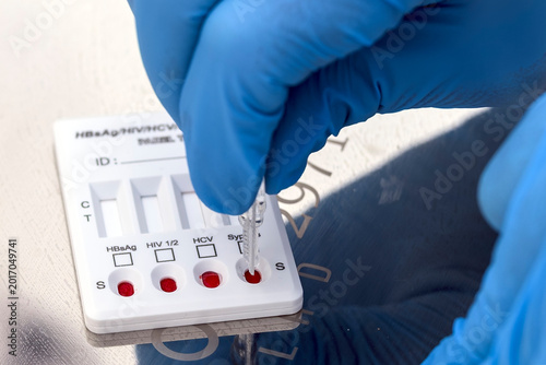 Medical professional in blue nitrile gloves applying blood samples to a rapid multi-panel diagnostic test cassette for HIV, Hepatitis B, Hepatitis C, and Syphilis screening.