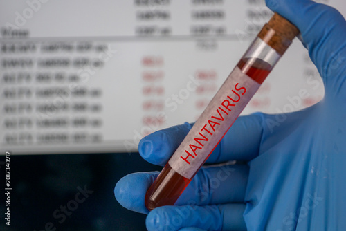 hantavirus test tube blood sample hand blue glove cruise ship background sea water medical diagnostics infection control laboratory analysis with copy space, medicine, epidemiology
