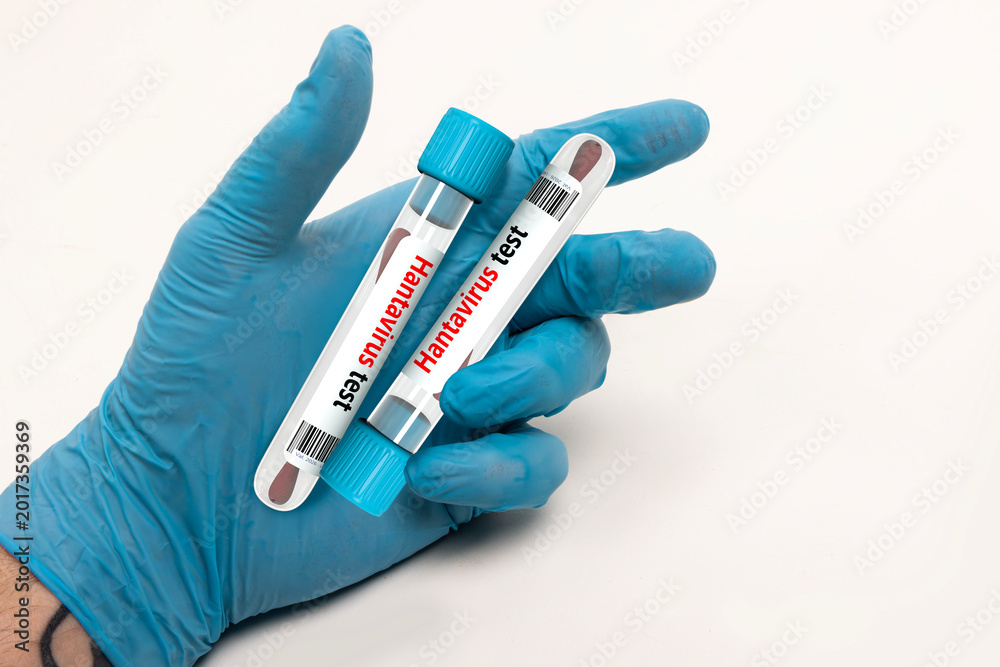 Obraz premium Hand in Blue Glove Holding Hantavirus Test Tubes with Cotton Swabs