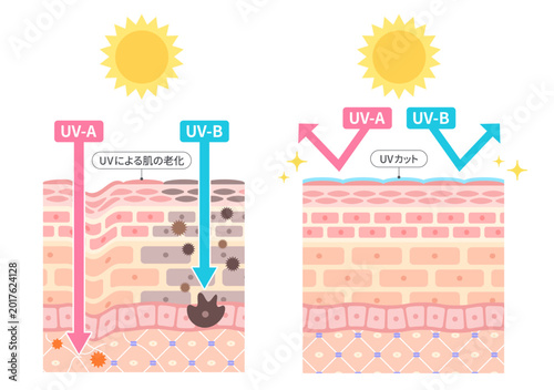 UV-AとUV-Bによる肌ダメージとUVカット効果の比較を肌断面図で表したイラスト