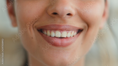 Close up female mouth smiling showing healthy white teeth dental oral care Indian Arabian woman unrecognizable girl whitening clinic medicine health toothy smile lady beauty detail indoors apartment