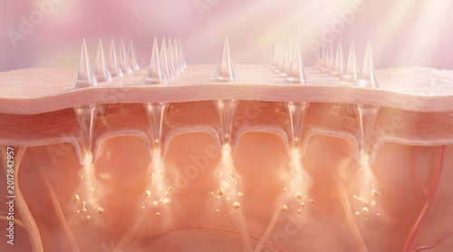 Microneedle patch on skin surface with golden particle absorbing into dermal layer below