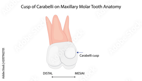 Photos Cusp of Carabelli on Maxillary Molar Tooth Anatomy
cusp of Carabelli on the mesial aspect of a maxillary molar tooth
