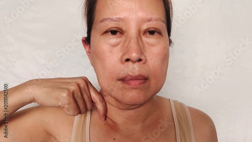 Foto portrait the fingers holding the flabbiness adipose sagging skin under the neck,neck wattle and cellulite, swelling and ptosis, forehead lines, freckles and blemish on the face,health care and beauty