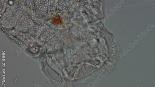Obraz na plátně Eosphora najas Rotifer Detail Under Brightfield Microscopy