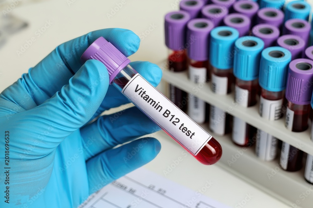 Naklejka premium Medical professional holding a blood test tube labeled Vitamin B12 test in a clinical laboratory setting