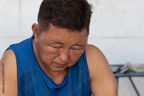 Konstfotografi Portrait of a middle aged man experiencing breathing difficulty and severe facial swelling caused by allergic reaction to hair dye chemicals and cosmetic exposure