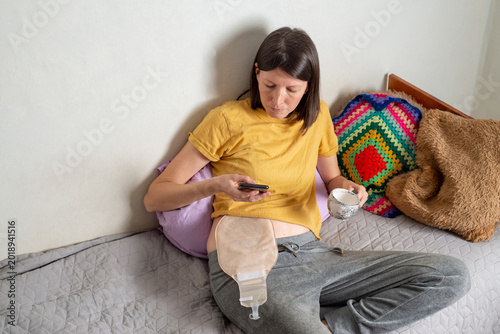 Slika na platnu Young woman with a colostomy bag sits on her bed and looks at the phone at home