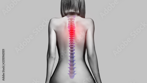 Photos Naked back of a woman with inflamed spine, isolated on grey background