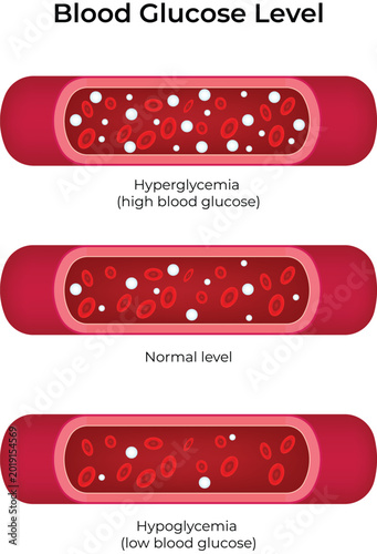 Blood Glucose Level Design Vector Illustration
