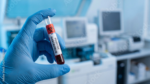 Gloved hand holding positive hantavirus test vial with biohazard symbol in clinical laboratory, infectious disease diagnosis, virus testing, contamination risk, medical research, healthcare analysis