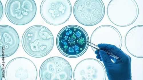 Microbiological Research in Laboratory with Petri Dish Cultures and Gloved Hand using Tweezers to Examine Bacterial Growth