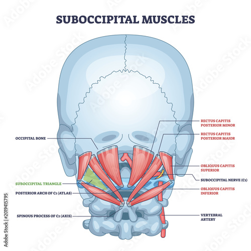Photos Suboccipital muscles diagram showing deep neck stabilizers, highlights rectus capitis, obliquus capitis, and suboccipital triangle for head posture and motion