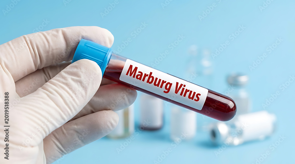 Obraz premium Medical professional holding a blood sample test tube with Marburg Virus label for diagnostic testing in a laboratory.