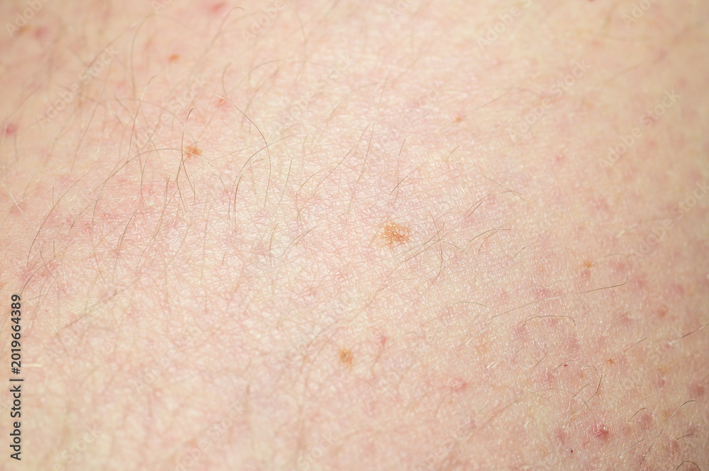 Fototapeta premium Close-up macro view of human skin texture with fine hairs and small blemishes