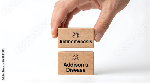 Hand stacking wooden blocks labeled Actinomycosis and Addison's Disease, rare bacterial infection and endocrine disorder medical awareness concept, isolated on white background