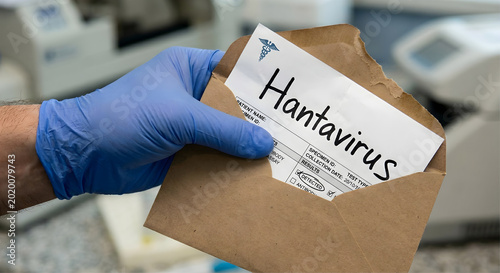 Main gantée tenant une enveloppe de résultats de test Hantavirus dans un laboratoire de diagnostic