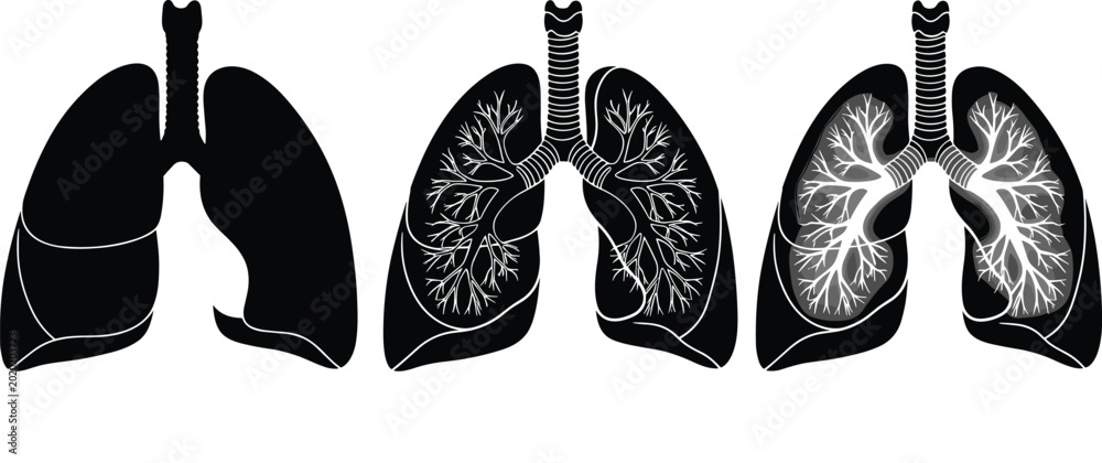 Εκτύπωση καμβά Human lungs anatomy vector illustration set with bronchial tree details for medi