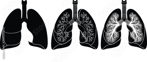 Photos Human lungs anatomy vector illustration set with bronchial tree details for medi