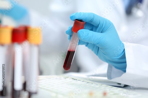 Hand holding blood sample analyzing medical test tube