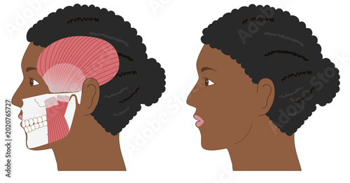 Tableau sur toile Comparison set of anatomical illustrations of a Black woman’s profile with overl