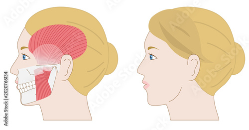 Photos Comparison set of anatomical illustrations of a White woman’s profile with overl