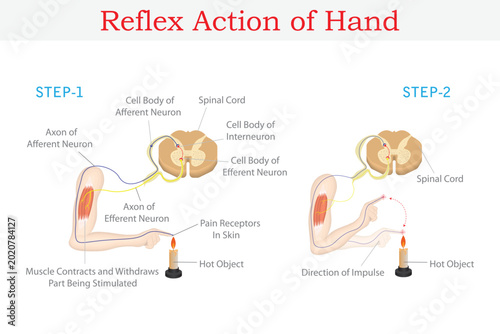Bild auf Leinwand Reflex Action of Human Hand with Spinal Reflex Arc and Withdrawal Response to Hot Object Educational Medical Illustration