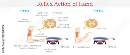 Bild auf Leinwand Reflex Action of Human Hand Showing Neural Pathway and Withdrawal Response to Hot Object Medical Illustration
