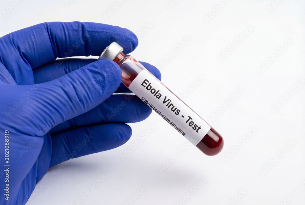 Fototapeta premium Gloved hand presenting test tube with ebola virus blood sample for testing