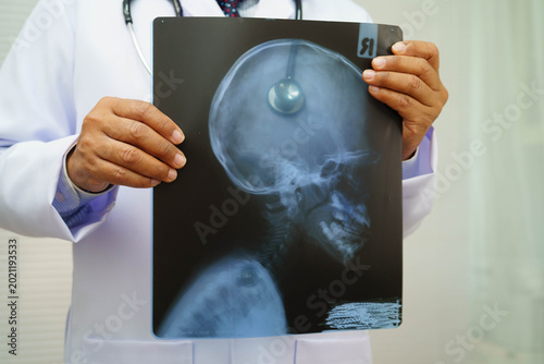 Quadro em tela Doctor examining brain radiography xray film.
