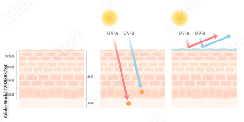 Bild auf Leinwand シンプルな肌構造図とUV-A・UV-Bによる紫外線ダメージとUVカットの綺麗な図解イラスト