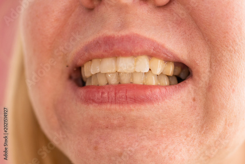 Woman showing teeth for dental examination. Close up of mouth and smile. Concept of oral hygiene, stomatology and dental checkup to monitor dental health and tooth condition in clinic.