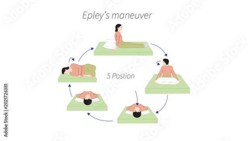 Bild auf Leinwand Epley Maneuver for Benign Paroxysmal Positional Vertigo (BPPV)
Epley maneuver used to treat benign paroxysmal positional vertigo (BPPV) and reposition inner ear crystals