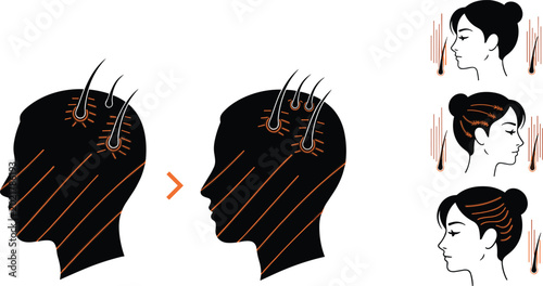 Tableau sur toile Hair growth treatment and scalp therapy illustration with female profile and fol