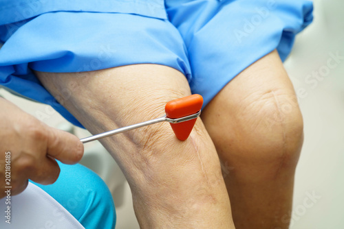 Canvastavla Asian doctor knock on knee reflex nerve for check and treatment senior patient in hospital