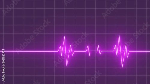 heartbeat pulse monitor signal 