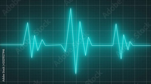 heartbeat pulse cardiogram signal