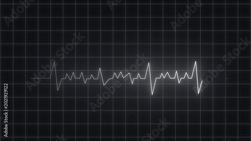 heartbeat pulse monitor signal 