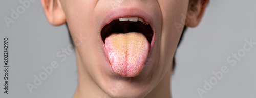 Obraz na plátně Tongue