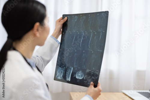 Photography Asian Female Doctor in White Coat Reviewing X-ray Image