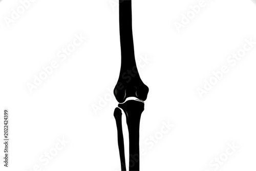 Tablou pe pânză Human Knee Silhouette: An artful silhouette of the human knee joint, showcasing its intricate structure and anatomical precision