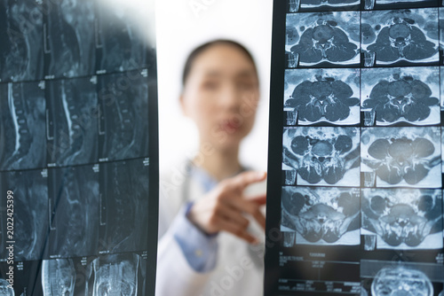 Canvas Print Asian Female Doctor in White Coat Reviewing X-ray Image