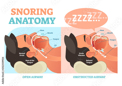 Obraz na plátne Snoring anatomy medical diagram with nose, mouth, tongue and air passage, transparent background