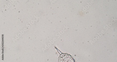 Microscopic rotifer swimming in a water droplet