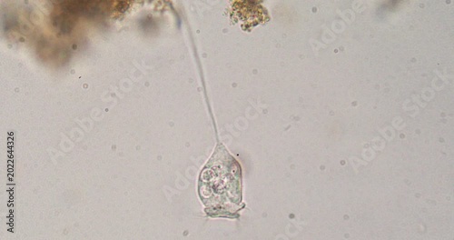 Vorticella protozoan extending and retracting stalk