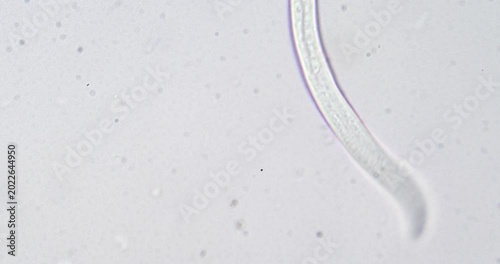 Microscopic nematode worm moving under microscope